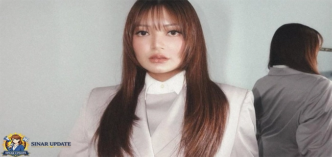 Penampilan Siti Badriah Usai 2 Bulan Oplas Payudara